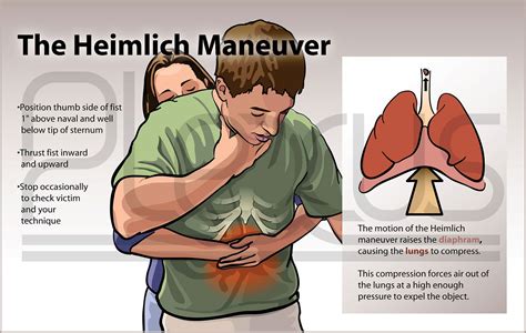 heimlich Search